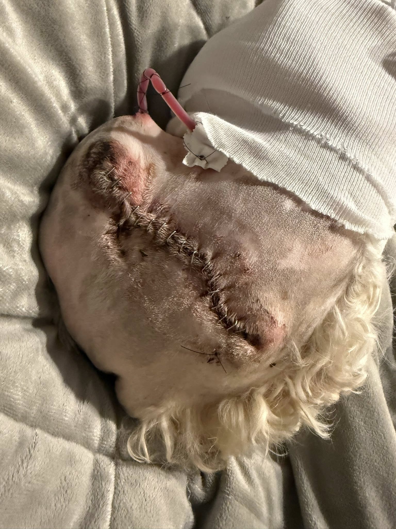 Kona injury recovery